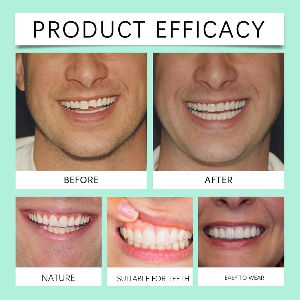 Soft Denture Silicone Veneers, Upper and Lower Denture Set K795670